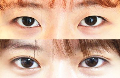 蚌埠醫(yī)學(xué)院第一附屬醫(yī)院眼科權(quán)威專家推薦！