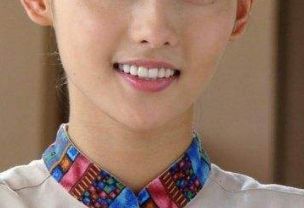 濟(jì)南芭莎美恩吳院長的醫(yī)術(shù)如何？親身雙眼皮成功案例分享！