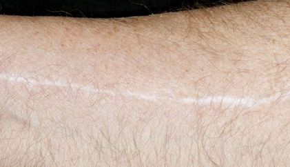 《青島王醫(yī)生的雙眼皮手術效果如何？專業(yè)簡介與真實案例分享》