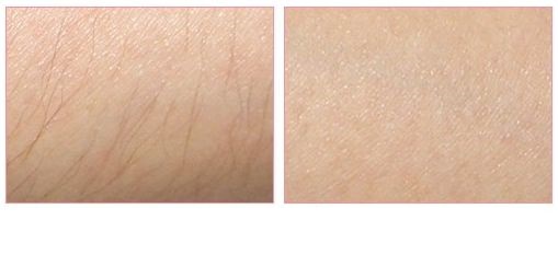 沈陽(yáng)沈河盛京尚美醫(yī)療美容門(mén)診部值得信任嗎？當(dāng)?shù)鼐用駥?duì)其口碑如何評(píng)價(jià)？