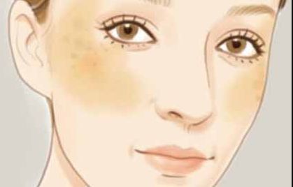 嘗試挑戰(zhàn)的你是否好奇劉珍君雙眼皮質(zhì)量如何？