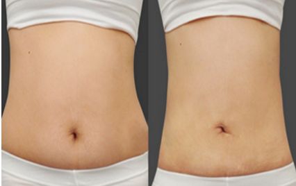 河北雙眼皮修復(fù)頂級醫(yī)院盤點(diǎn)，熱門就醫(yī)選擇一覽！