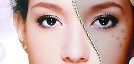 周一雄如何預(yù)約雙眼皮手術(shù)？案例分享與價格真實(shí)評估