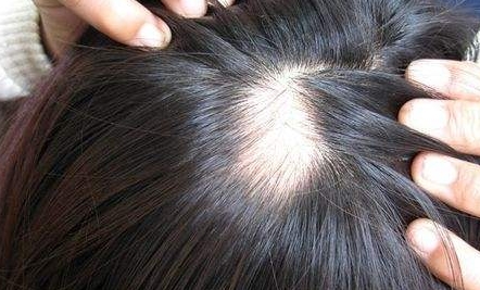 重慶鵬愛醫(yī)療美容醫(yī)院的特色項目與醫(yī)生團隊是否一鍵獲取可信賴？