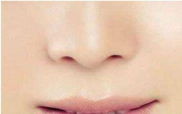 北京唇裂修復(fù)有哪些醫(yī)院可以選擇？醫(yī)術(shù)優(yōu)秀，口碑良好的醫(yī)院有哪些？