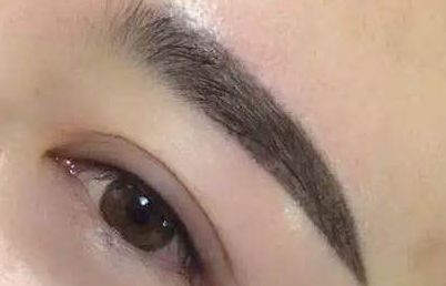 廈門(mén)鄭亞榮醫(yī)師就醫(yī)經(jīng)歷如何？患者真實(shí)案例分享及診療費(fèi)用明細(xì)更新！