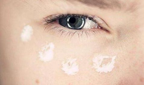 皮肉腔軟骨隆鼻手術(shù)費用如何？鼻部整形手術(shù)安全可靠，詳細操作圖解！