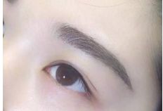 重慶銅雀臺(tái)地區(qū)雙眼皮手術(shù)頂級醫(yī)生推薦！詳細(xì)收費(fèi)一覽表