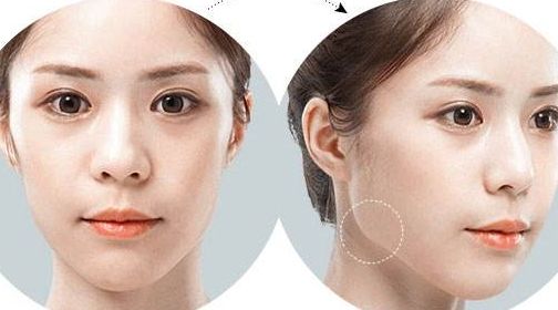 北京五家專(zhuān)業(yè)美容醫(yī)院熱門(mén)推薦，實(shí)力醫(yī)院排行榜快來(lái)收藏！