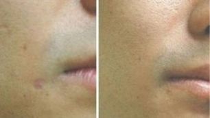 江蘇省人民醫(yī)院眼科頂尖大咖曬出｜五位名醫(yī)的醫(yī)術(shù)實力和口碑共享