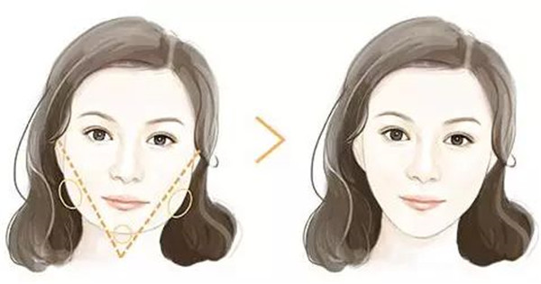 深圳吸脂修復(fù)醫(yī)院哪家專業(yè)？這八強(qiáng)機(jī)構(gòu)到底有何絕技？