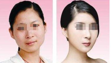 邵陽市比較好的整形醫(yī)院排行榜更新