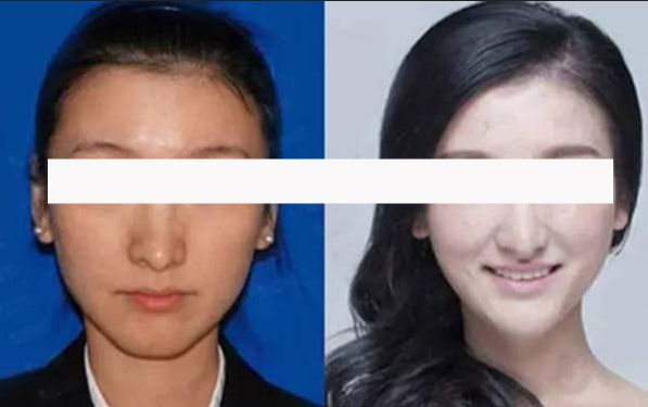 沈陽(yáng)市優(yōu)質(zhì)醫(yī)院雙眼皮手術(shù)排行榜，哪些醫(yī)院口碑良好？