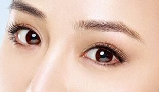 成都米蘭柏羽雙眼皮曝光！醫(yī)生做雙眼皮風(fēng)格如何？對(duì)比照片供參考