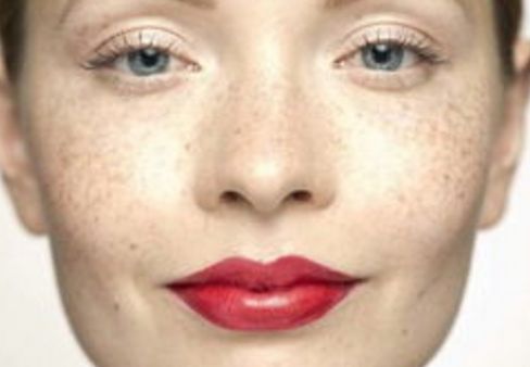 曙光整形醫(yī)院受追捧，隆鼻成功案例分享