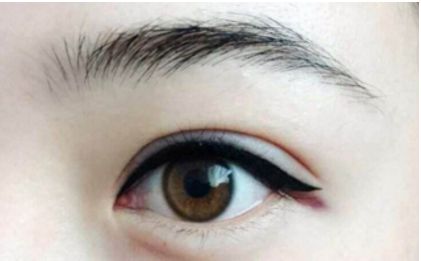 全國蜚聲修復(fù)雙眼皮大師排行榜