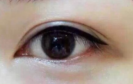 上海9院專家分享軟骨隆鼻案例，LiQingfeng的技術(shù)備受推崇！