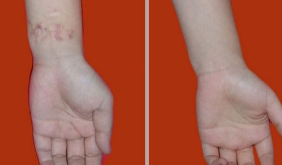 冬季補水逆轉肌膚暗沉，白皙水潤大蛻變