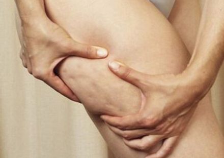 深圳哪家醫(yī)院拉皮手術(shù)效果好？專家推薦米蘭柏羽、美萊、藝星等醫(yī)院