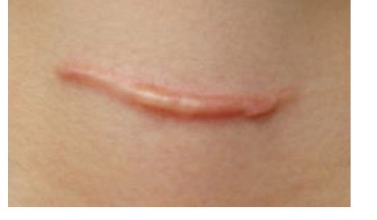 殷佳鵬整形醫(yī)生的技術(shù)與價(jià)格如何？