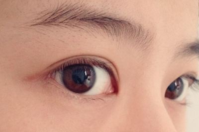 如何選擇適合自己的祛斑醫(yī)院？哪些醫(yī)院是值得嘗試的？