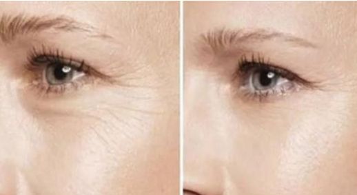 昆明雙眼皮手術(shù)哪家醫(yī)院靠譜？這三家值得了解