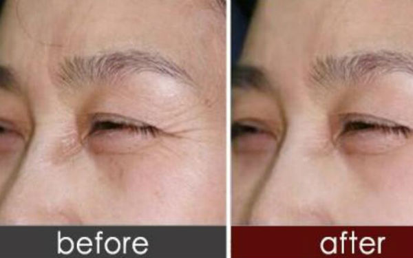 懷化哪家醫(yī)生能治療O型腿矯正？極力推薦的具體醫(yī)生是誰？