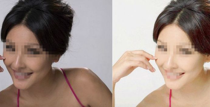 鄭州第二中醫(yī)院專家推薦：私密整形服務(wù)詳解，朱靜醫(yī)生實(shí)力解讀