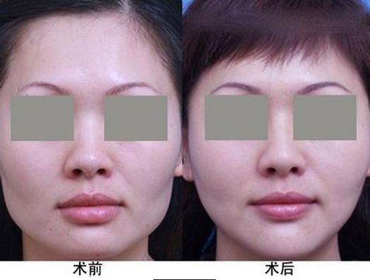 中國(guó)最受歡迎的十大整形醫(yī)院評(píng)選結(jié)果公布