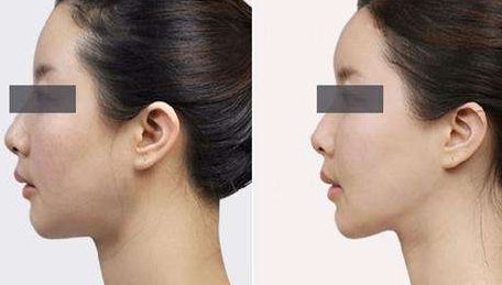 重慶鼻部修復(fù)優(yōu)質(zhì)醫(yī)療機(jī)構(gòu)排行榜