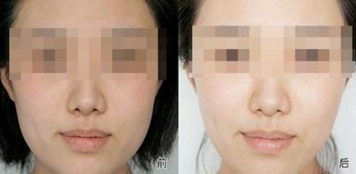 上海值得選擇的拉皮醫(yī)院