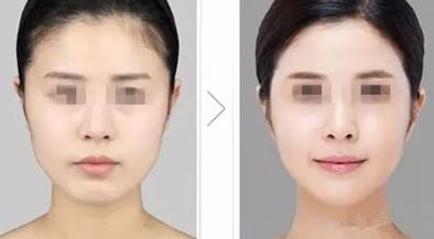 天津整形醫(yī)院綜合師資力量、設(shè)備設(shè)施等實力分析