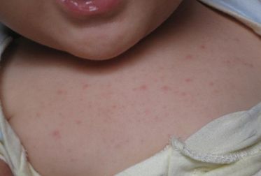 張凱華醫(yī)生：秦皇島巧致整形醫(yī)院人氣美膚專家激光祛斑分享