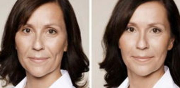 西安哪家醫(yī)院做隆鼻好？整形鼻部醫(yī)院匯總6家