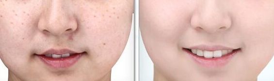 醫(yī)生工作室的預(yù)約方式介紹！蘇薇潔醫(yī)生眼整形工作室的成功案例展示！