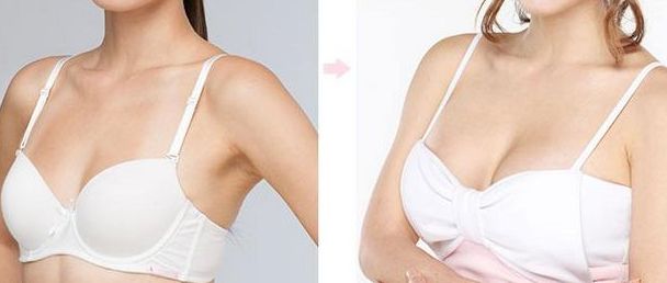 濟(jì)南第二人民醫(yī)院雙眼皮手術(shù)費(fèi)用和名醫(yī)推薦，有成功案例參考