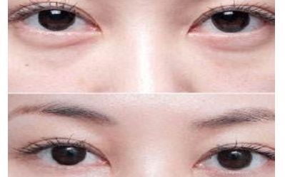 云南雙眼皮醫(yī)生排行榜2023：揭秘5位頂尖專家，讓您輕松煥發(fā)雙目魅力！