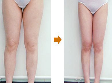 上海柴軍醫(yī)生的鼻子整形案例亮相，效果如何？