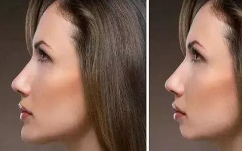 福建省婦幼保健院整形外科服務(wù)指南：手術(shù)費(fèi)用詳解