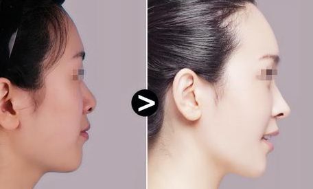 鄭州雙眼皮醫(yī)院綜合排行榜揭曉！權(quán)威榜單揭示雙眼皮醫(yī)療技術(shù)的精髓