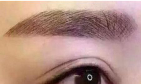 九院瞬間靚眼，告別上眼瞼下垂困擾，醫(yī)術(shù)專業(yè)獨具慧眼！