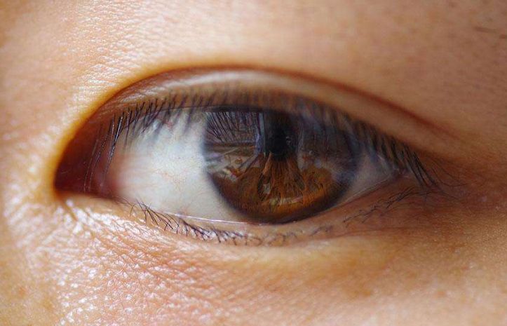 美域高醫(yī)療為您展示全新隆鼻案例，賦予您完美鼻型！