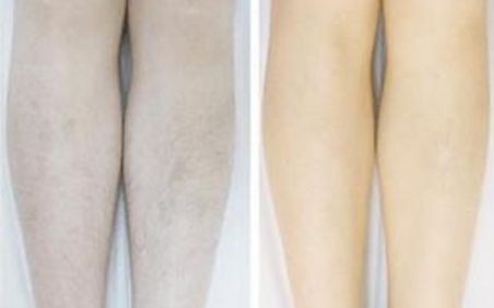 重慶植入乳房改良領先醫(yī)院：五佳選擇推薦