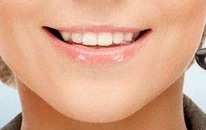 上海九院口腔科高手任國(guó)欣醫(yī)師的牙齒矯正技藝及成功案例解析