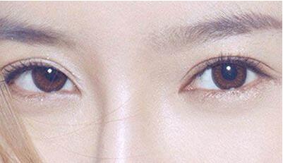 2023河北滄州整形醫(yī)院匯總前五結(jié)果，哪家靜港、水芙蓉、京美更可靠？