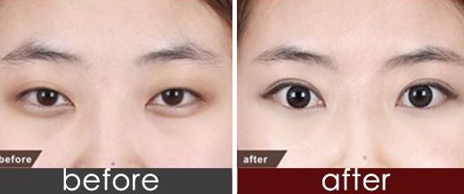 上海市九院品牌種植牙醫(yī)生推薦！頂尖口腔權(quán)威專家聯(lián)合推薦，價格一覽！