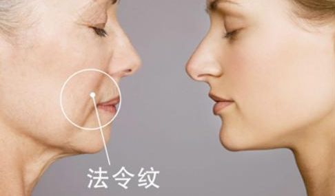 武漢雙眼皮醫(yī)生哪些技術強？陳宏案例揭秘前五強！