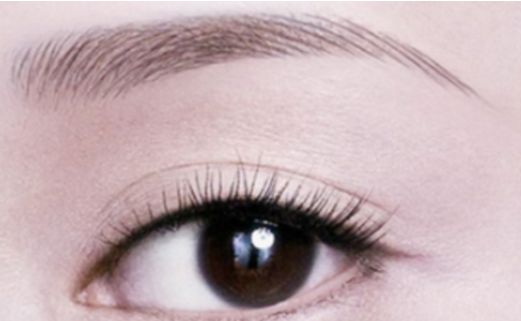 雙眼皮手術合適的適齡階段是哪個年紀段位更勝一籌？