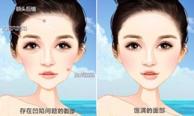 韓國整形醫(yī)院磨骨項目專家排行榜優(yōu)選