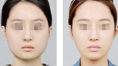 周海峰醫(yī)生受邀無錫坤如瑪麗醫(yī)院擔(dān)任醫(yī)療顧問，技術(shù)專業(yè)可信賴